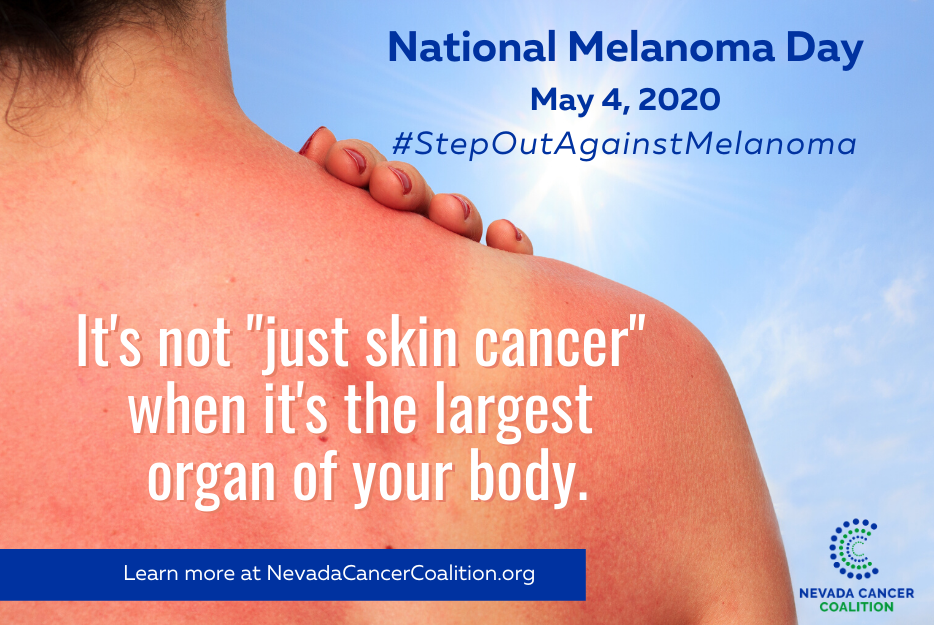 Melanoma Monday Message It Matters Nevada Cancer Coalition
